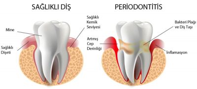 Samsun Periodontoloji